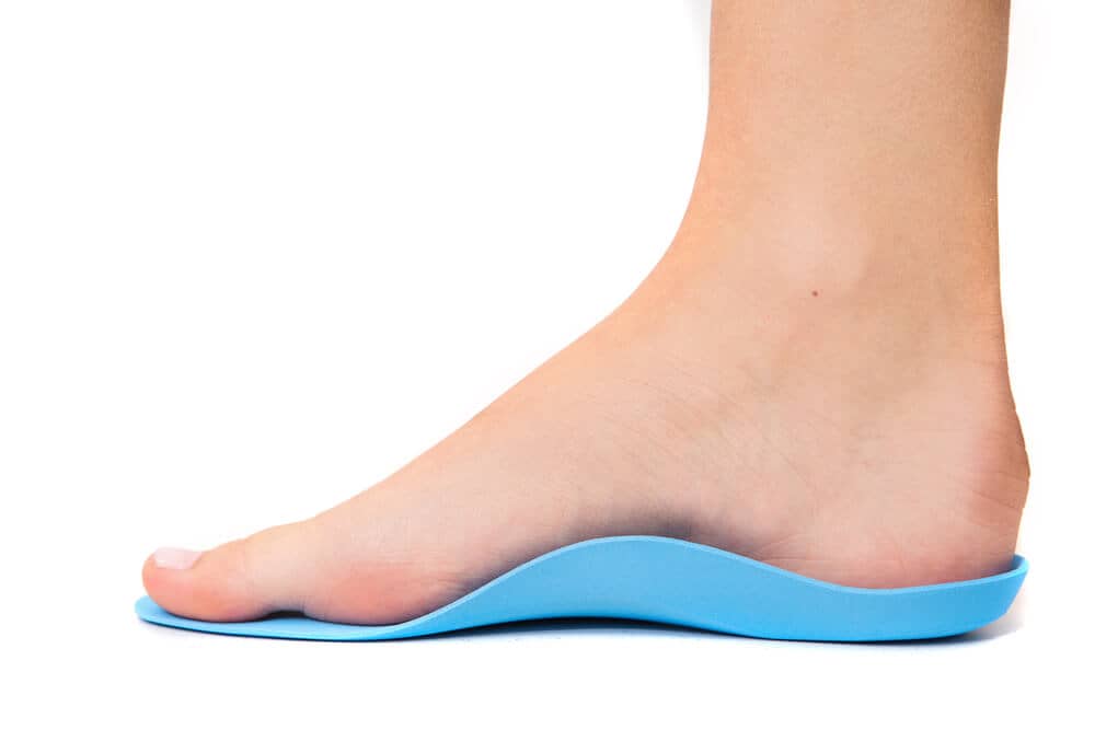 Over The Counter Insoles VS Custom Foot Orthotics