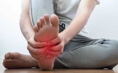 Foot Arch Pain: What It Is and How To Treat It