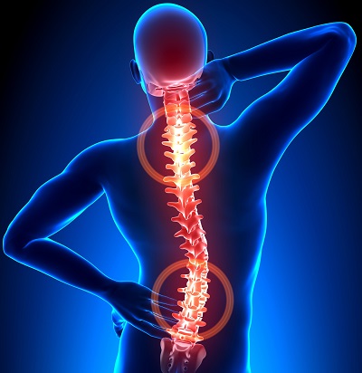 BACK-PAIN