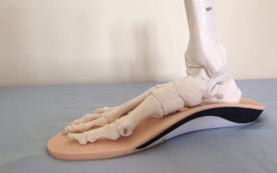 The Benefits of Foot Orthotics
