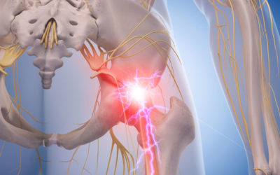 How To Treat Nerve Pain at Home