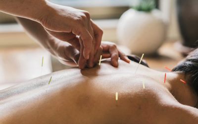 Why Athletes Need An Acupuncturist On Their Team