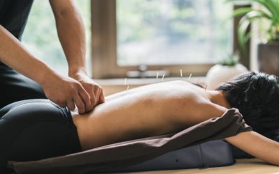 4 Types Of Pain Acupuncture Can Heal
