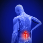 Low Back Pain Treatment With SMT