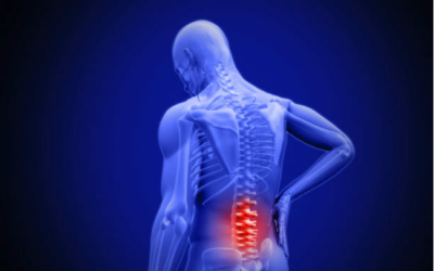 Treating Low Back Pain With Spinal Manipulation Therapy